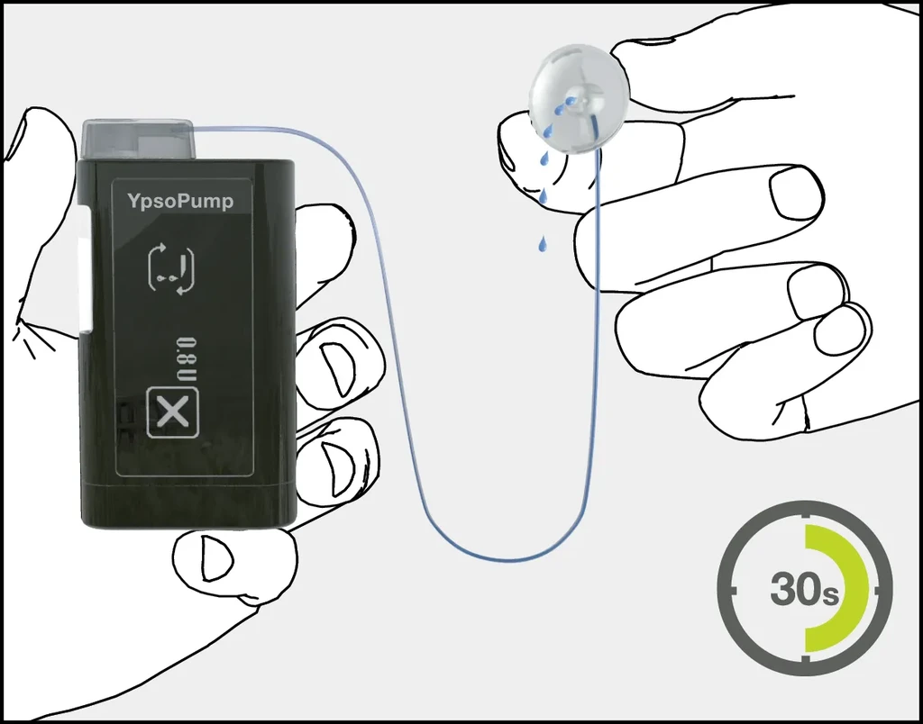 mylife Diabetes Care AG