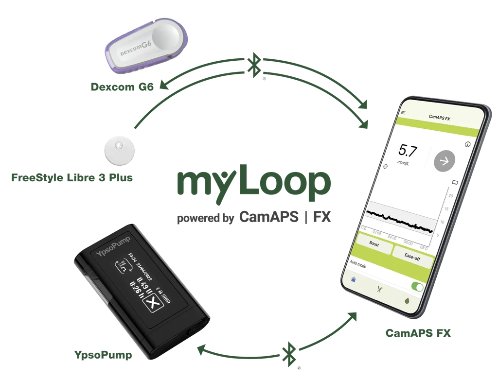 YpsoPump insulin pump